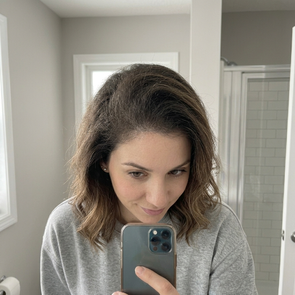 PRACTS Håravfallsbehandling